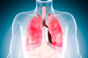 Hipertensão pulmonar é uma doença que afeta as artérias pulmonares.