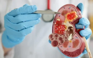 Rins doentes apresentam alguns sintomas e sinais.