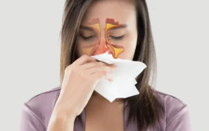 Sinusite: desconforto causado por inflamação nas cavidades do nariz, maçãs do rosto e olhos.