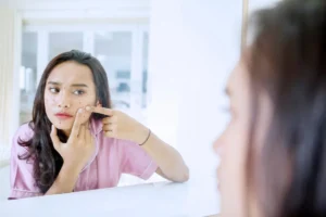 Mulher jovem espremendo cravos e espinhas no seu rosto.
