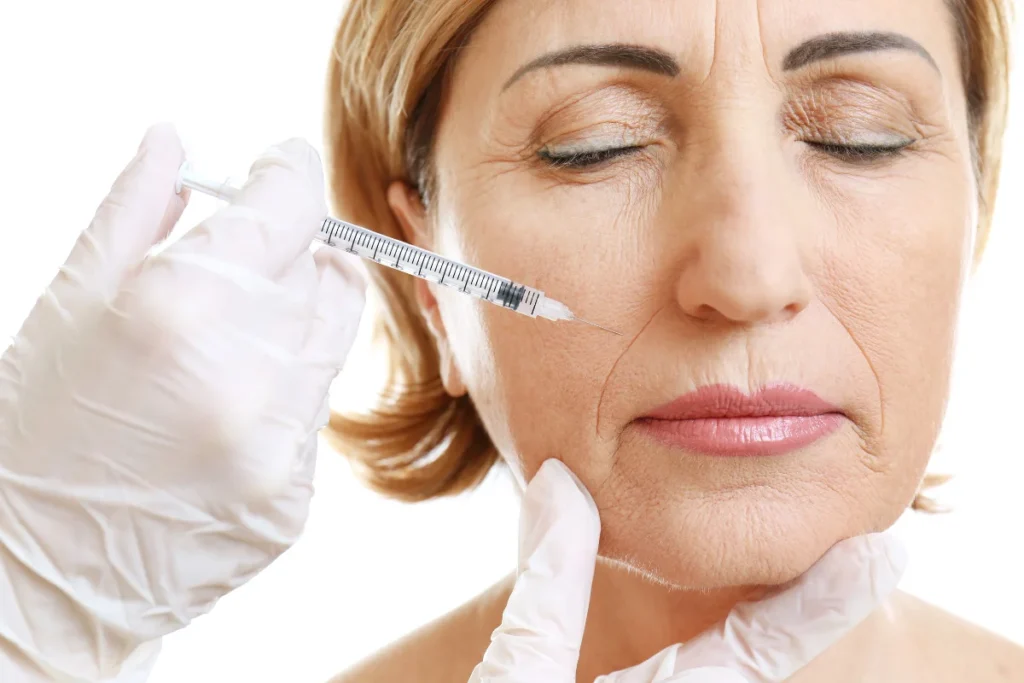 Aplicação de ácido hialurônico para rejuvenescimento facial.