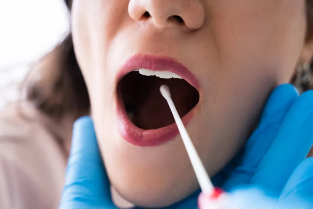 Médico realizando exame PCR em paciente para detecção de bactérias. 