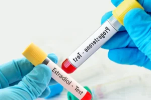 Realização do teste hormonal para determinar necessidade de reposição hormonal feminina.